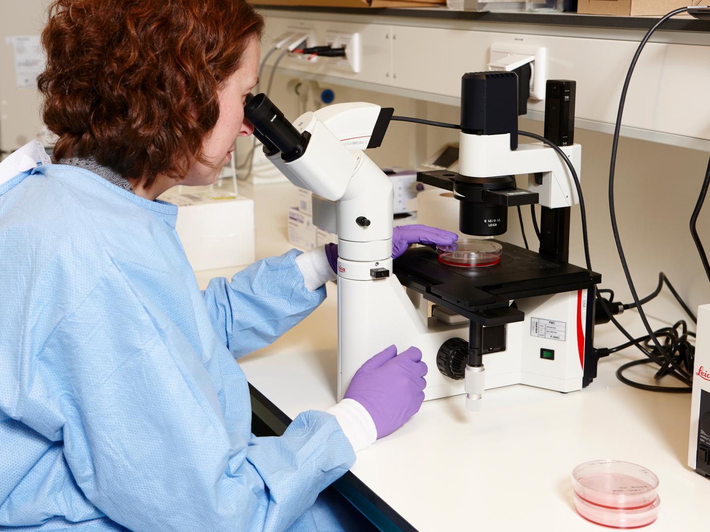 Nieuw type kankercel gevonden bij kinderen met neuroblastoom