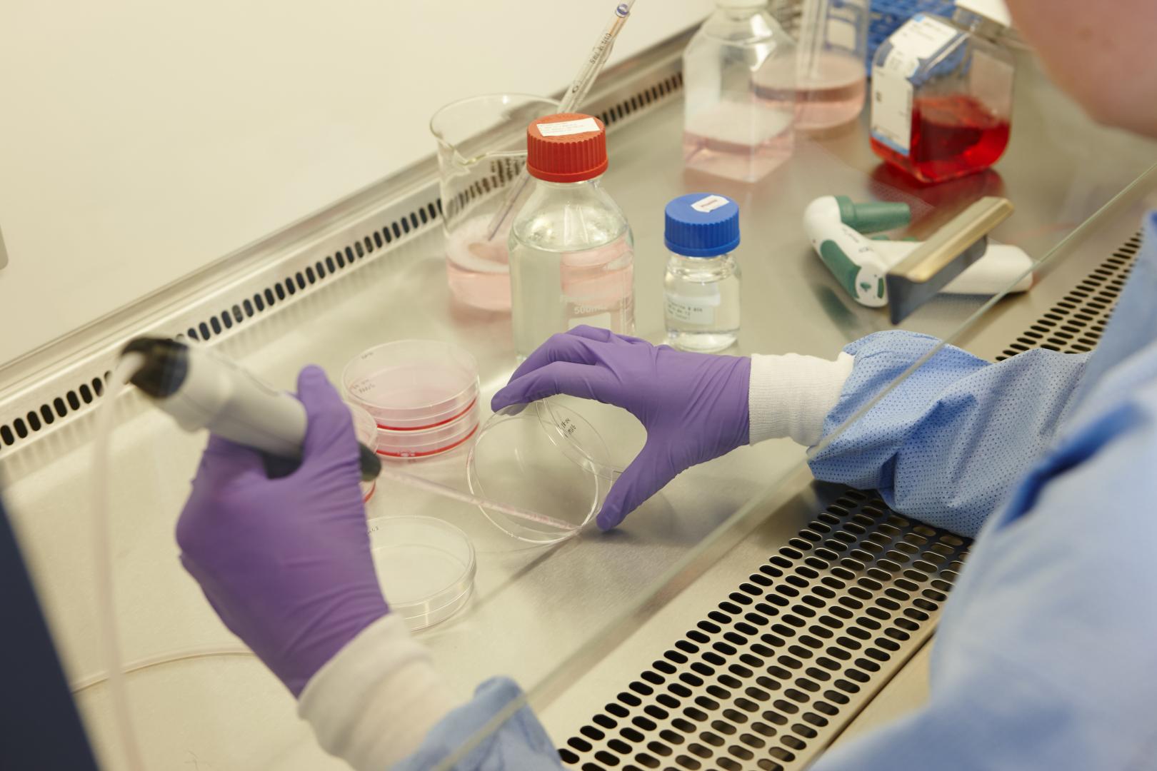 stamceltransplantatie