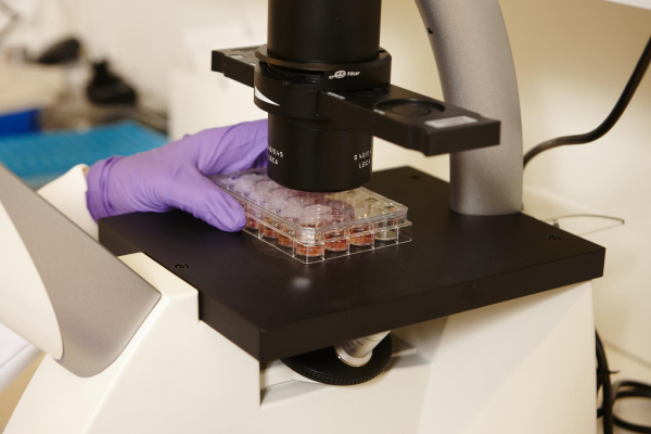 acute lymfatische leukemie